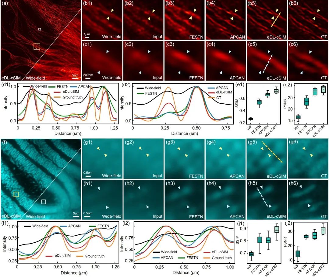 前沿 | 深度学习赋能活细胞超分辨成像_前沿 | 深度学习赋能活细胞超分辨成像_